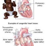 Heart Disease Risk Linked to Earlier Depression Onset in Men