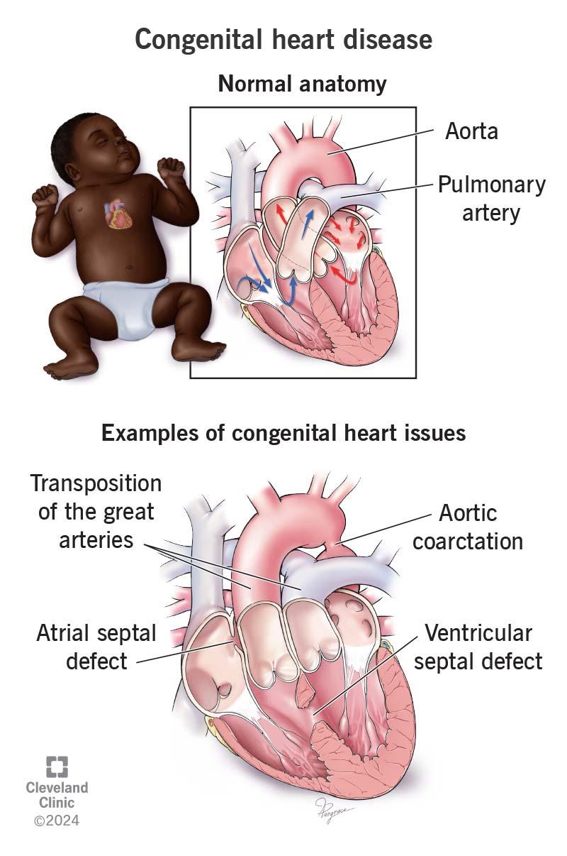 Heart Disease Risk Linked to Earlier Depression Onset in Men