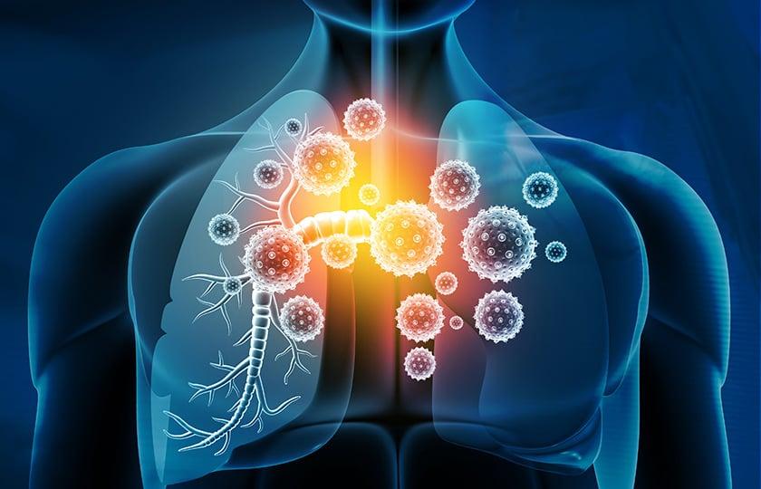 Viral Respiratory Infections: Antibiotics Unnecessary in 90% of Cases