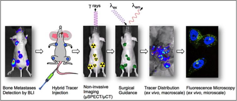 Multimodality Imaging Guides Treatment for Mitral Regurgitation in Young Woman