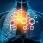 Viral Respiratory Infections: Antibiotics Unnecessary in 90% of Cases