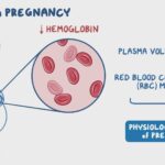 Anemia in Pregnancy Linked to Cognitive Function Changes