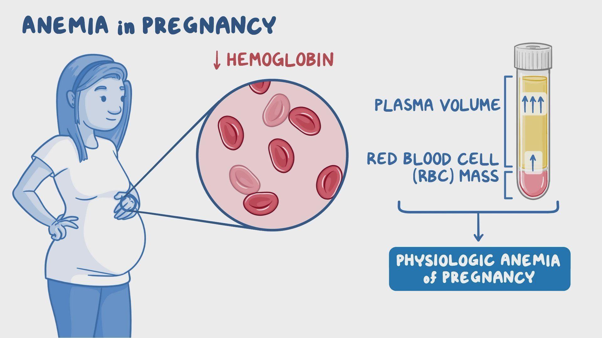 Anemia in Pregnancy Linked to Cognitive Function Changes