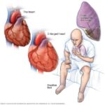 AI Heart Failure Screening Tool Shows Long-Term Cost Savings