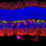 GLP-1 Drugs and Vision Loss: New Meta-Analysis Investigates Rare Risk