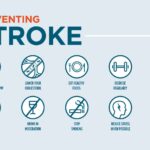 Stroke Prevention: Crucial Advice for Under 50s