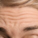 Forehead Wrinkles Linked to Higher Risk of Heart Disease Death