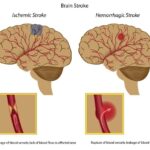 Sprain Brain Bats Embrace ‘Roots & Herbs