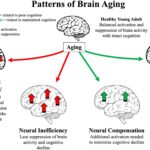 Brain Aging Proteins Spike at 57, 70, and 78