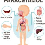 New Paracetamol Side Effects: Expert Tips to Avoid Medication Overuse | Health News